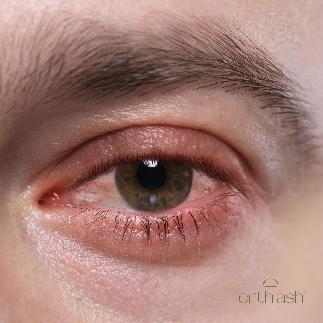 Prostaglandins and Lash Growth: What You Need to Know